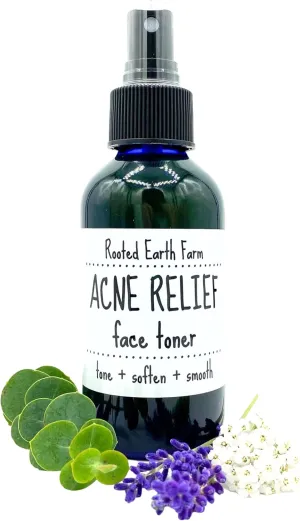 Acne Relief Face Toner - 4 fl oz - for Clear Skin - Natural Astringent