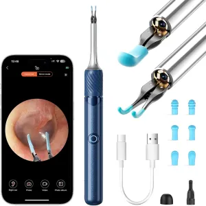 Ear Wax Removal - 2-in-1 Visual Otoscope - Ear Cleaner Tweezers with 6 Ear Spoon - Earwax Removal Kit with Light - Ear Cleaner with Camera - Ear Cleaner for iOS & Android (Blue)