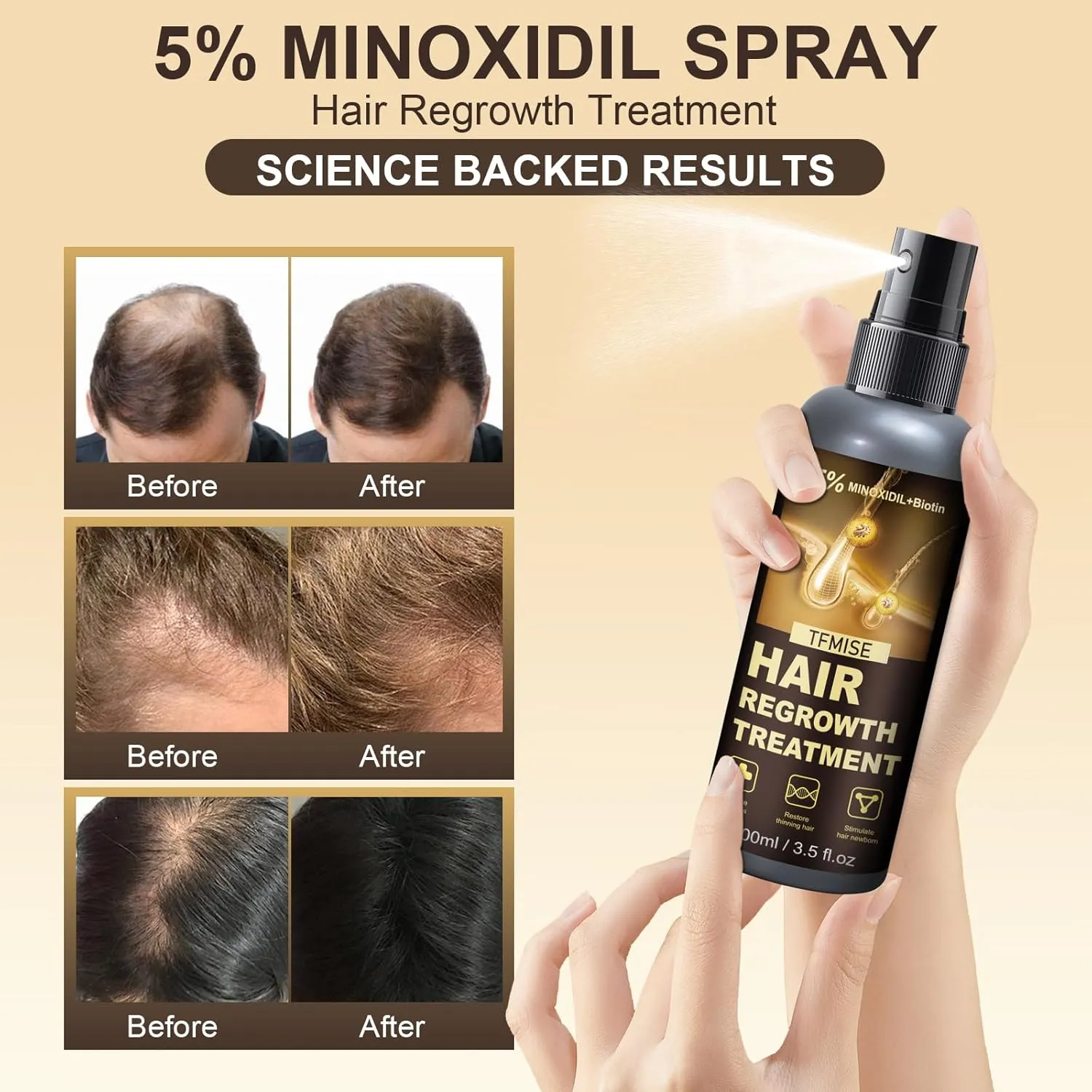 Minoxidil Spray - 5% Minoxidil for Men, Minoxidil for Women Hair Growth Products, Extra Strength Hair Regrowth Treatments with Biotin, Help to Stop Loss Hair Unscented Light and non Greasy 3.38 Fl.OZ