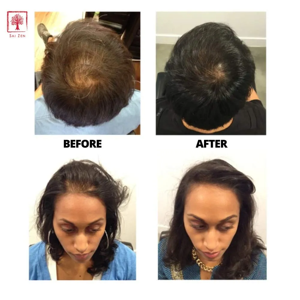 Volume Plus Scalp Therapy Spray | Post-Shower Hair Strengthening Formula | Made in USA |Alcohol and Paraben Free, 4 oz.