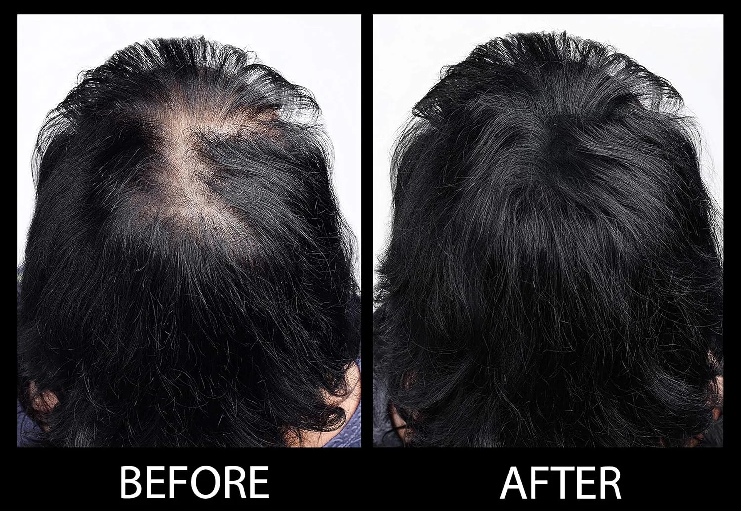 Volumizing Hair Fibers with real Keratin for Thinning Hair/Hair Loss – Dermatologist Tested and Certified Hypoallergenic - 60 days   supply - Multiple Colors Available (Black)