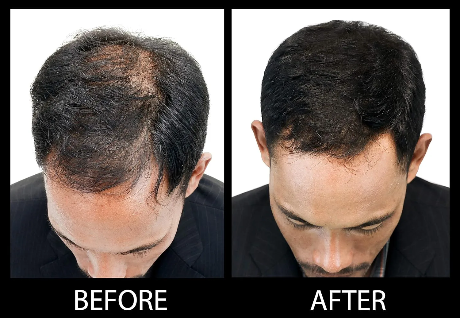 Volumizing Hair Fibers with real Keratin for Thinning Hair/Hair Loss – Dermatologist Tested and Certified Hypoallergenic - 60 days   supply - Multiple Colors Available (Black)