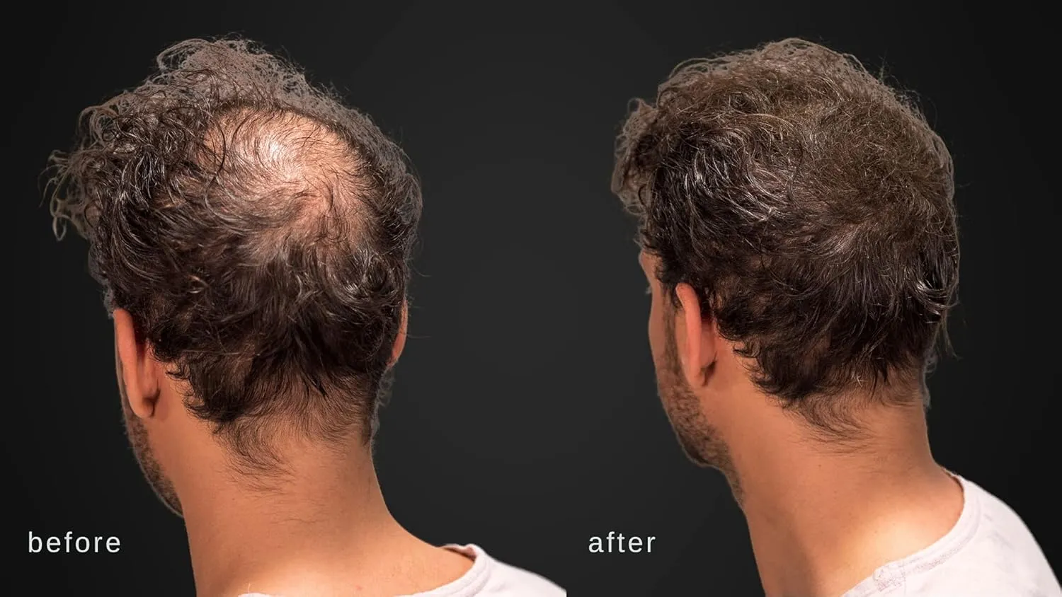 Volumizing Hair Fibers with real Keratin for Thinning Hair/Hair Loss – Dermatologist Tested and Certified Hypoallergenic - 60 days   supply - Multiple Colors Available (Black)