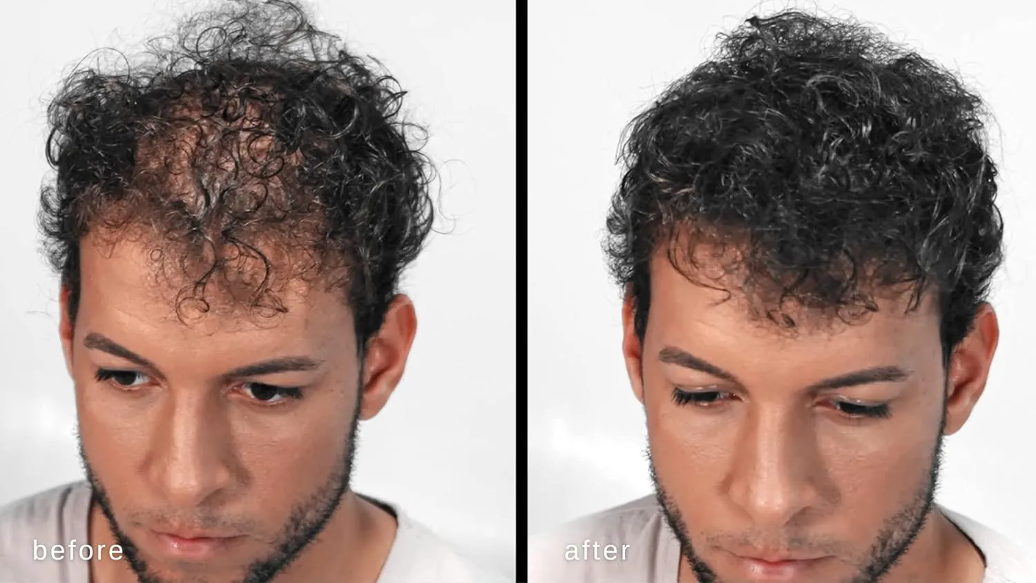 Volumizing Hair Fibers with real Keratin for Thinning Hair/Hair Loss – Dermatologist Tested and Certified Hypoallergenic - 60 days   supply - Multiple Colors Available (Gray)