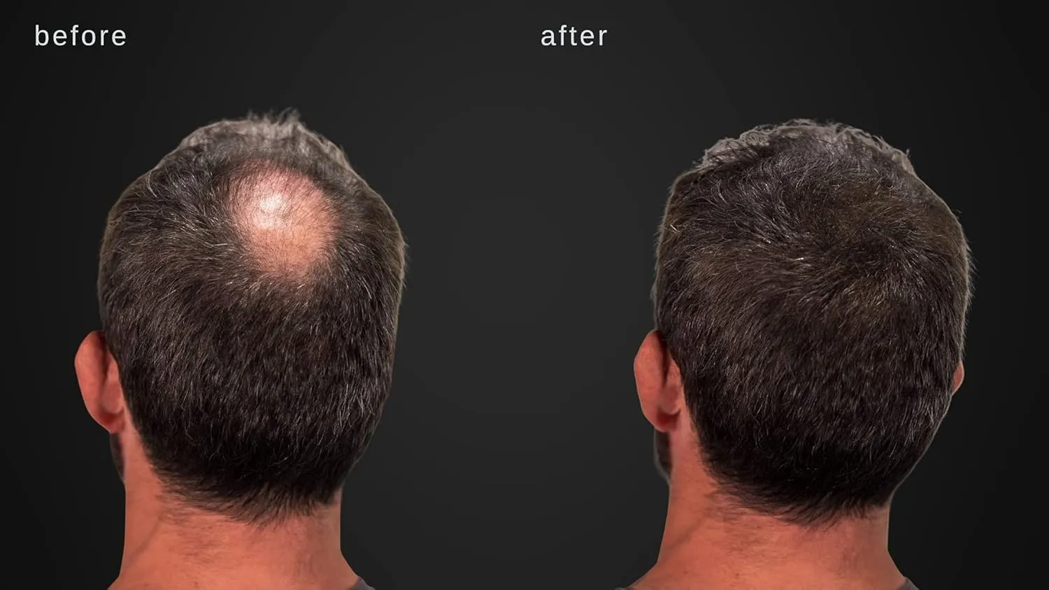 Volumizing Hair Fibers with real Keratin for Thinning Hair/Hair Loss – Dermatologist Tested and Certified Hypoallergenic - 60 days   supply - Multiple Colors Available (Gray)